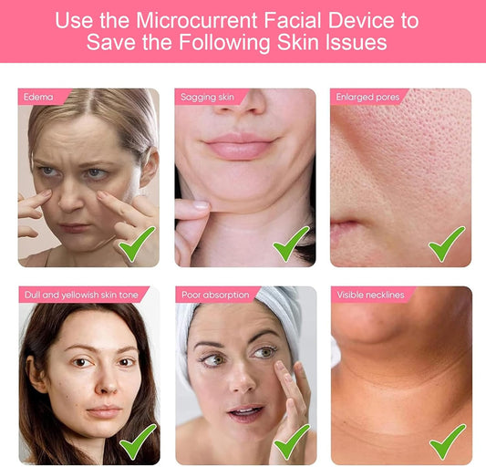 Use the Vynzo Microcurrent Face Lift & Massage Device to address skin issues like sagging skin and enlarged pores.